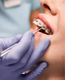 dental services